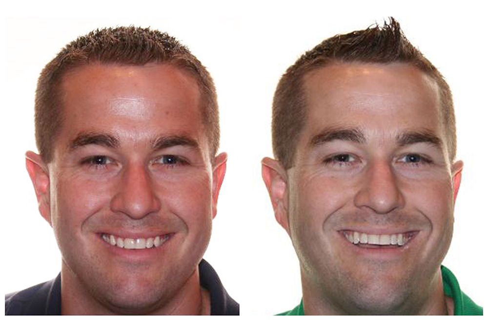 Advanced Dental Care