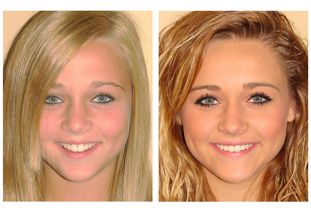 Advanced Dental Care